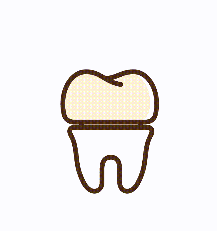 Dental crowns and tooth cap treatment in Guntur